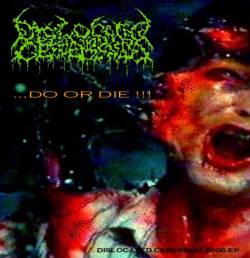 Dislocated Cerebrum : ...Do or Die